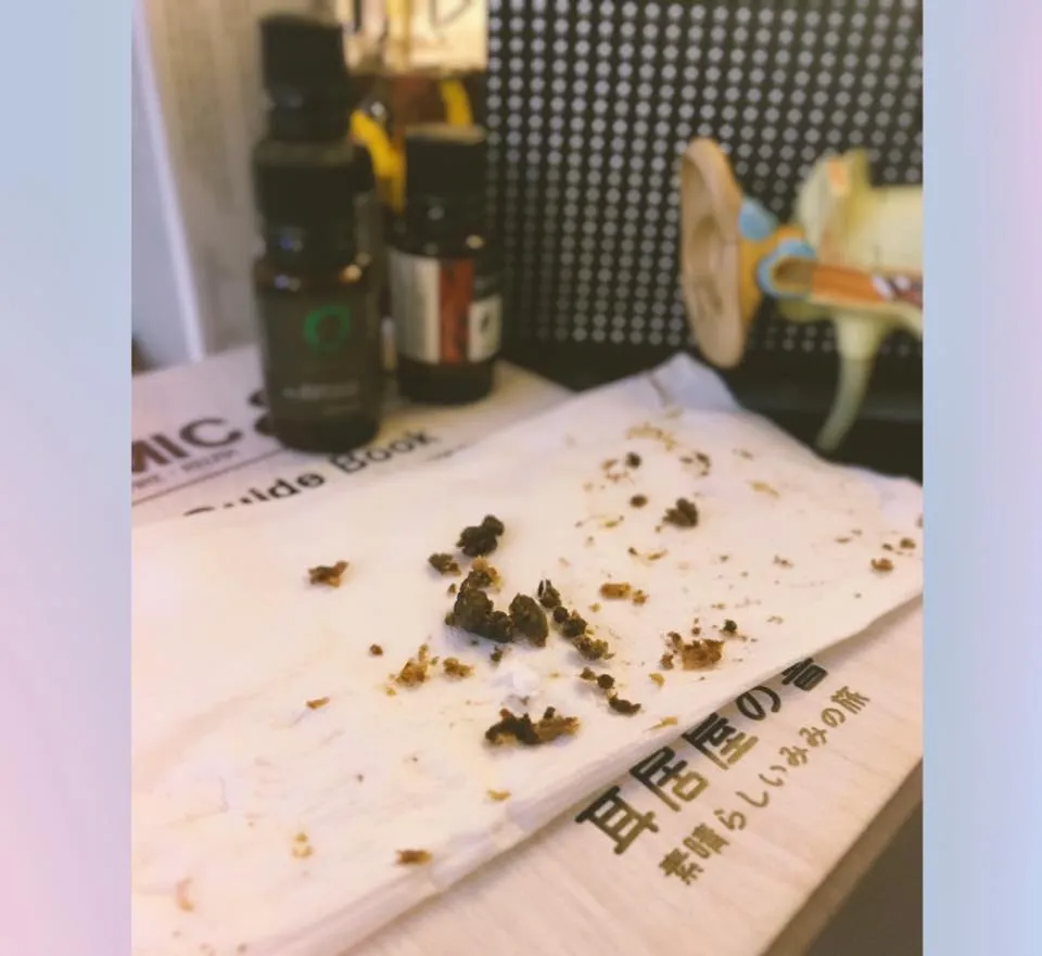 超大耳結石